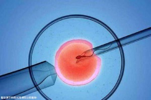 中医妇科